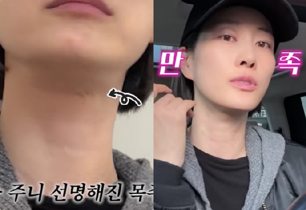 '44세' 이현이, 목주름 시술·보톡스 받았다..확달라진 애프터에 “만족”(워킹맘)