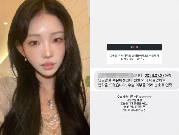 '골반괴사 3기' 최준희 “뼈 썩고 있는 상태...결국 인공관절 수술”
