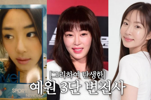 강예원 “코 수술에 눈만 7번, 성형 지긋지긋해”..앞트임 복원 후 털어놓은 속마음