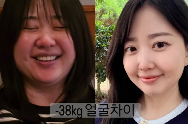 '박수홍♥' 김다예, -38kg 얼굴 차이에 깜짝 “눈 작아지고 코 커져”