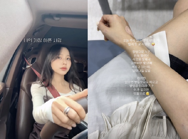 '박성광♥' 이솔이, 또 병원行…항암 고통에 혈관까지 녹았다 “검사 항목 많아”