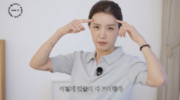'49세' 채정안 “안면거상술? 핏줄 다 보이는 피부라 위험해”