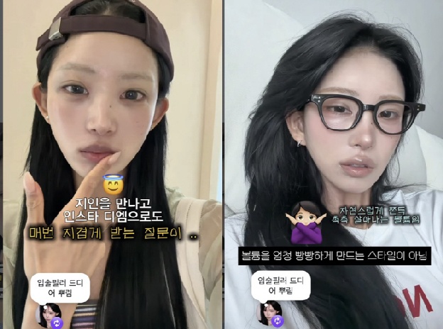 '故최진실 딸' 최준희, 입술 필러 또 맞았다 “18살부터 계속”