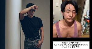 [이슈] 배우 전호준, 전여친 폭행 주장 정면 반박..“살려주세요” 핏자국 선명한 사진 공개